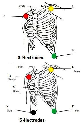 Position des électrodes Scope : position des électrodes précordiales