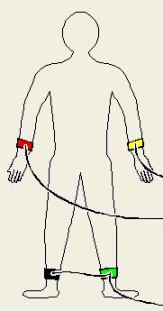 Scope électrodes ECG