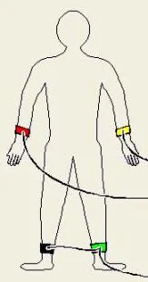 ECG électrocardiogramme position des électrodes ECG électrocardiogramme position des électrodes